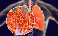 野餐一般什么时间合适呢?